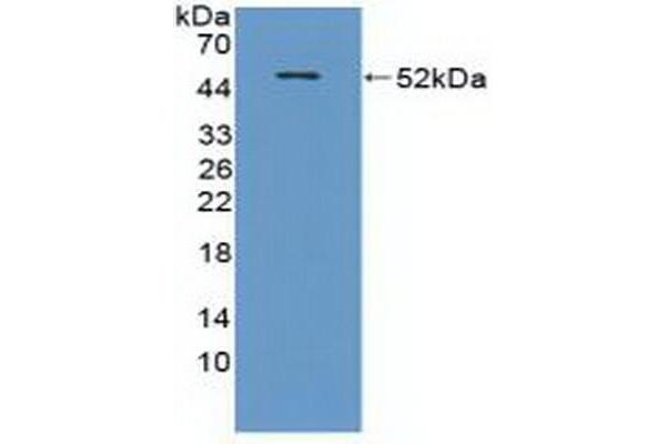 CRAT 抗体  (AA 1-430)
