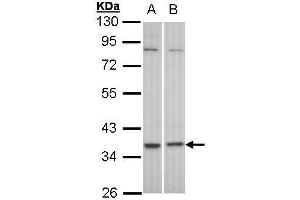 WB Image Sample (30 ug of whole cell lysate) A: HeLa B: Molt-4 , 10% SDS PAGE antibody diluted at 1:1000