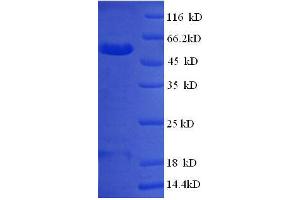 PITPNM1 Protein (AA 1-238, partial) (GST tag)
