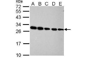 Image no. 5 for anti-Prohibitin (PHB) (Center) antibody (ABIN2854938)