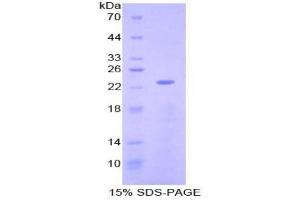 Image no. 1 for NME/NM23 Nucleoside Diphosphate Kinase 3 (NME3) protein (ABIN3010975)