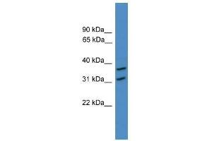 Image no. 1 for anti-OTU Domain Containing 6A (OTUD6A) (N-Term) antibody (ABIN929177)