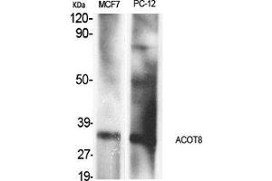 Image no. 2 for anti-Acyl-CoA Thioesterase 8 (ACOT8) (Internal Region) antibody (ABIN3183150)