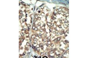 Image no. 2 for anti-Phosphatidylinositol 4-Kinase Type 2 beta (PI4K2B) (AA 305-336), (C-Term) antibody (ABIN5532966)