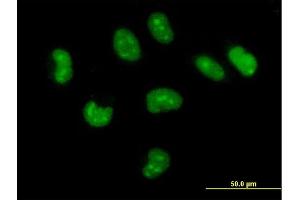 Image no. 2 for anti-CutC Copper Transporter Homolog (CUTC) (AA 1-273) antibody (ABIN526433)