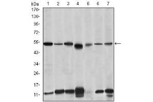 Image no. 3 for anti-Interleukin-1 Receptor-Associated Kinase 4 (IRAK4) antibody (ABIN1107881)
