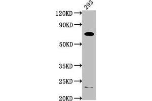 Western Blot Positive WB detected in: 293 whole cell lysate All lanes: PCSK9 antibody at 1:2000 Secondary Goat polyclonal to rabbit IgG at 1/50000 dilution Predicted band size: 75, 21 kDa Observed band size: 75 kDa