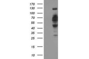 Image no. 3 for anti-DNA Cross-Link Repair 1B (DCLRE1B) (AA 1-280) antibody (ABIN2719245)