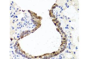 Immunohistochemistry of paraffin-embedded Rat lung using TOPBP1 Polyclonal Antibody at dilution of 1:100 (40x lens).