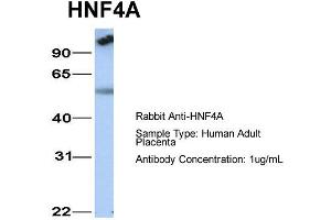Image no. 3 for anti-Hepatocyte Nuclear Factor 4, alpha (HNF4A) (N-Term) antibody (ABIN2777514)