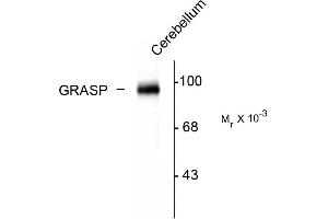 Image no. 1 for anti-GRIP1 Associated Protein 1 (GRIPAP1) (C-Term) antibody (ABIN361431)
