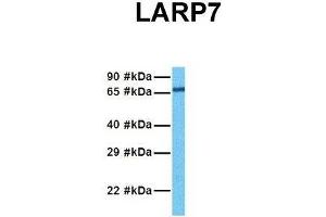 Image no. 3 for anti-La Ribonucleoprotein Domain Family, Member 7 (LARP7) (C-Term) antibody (ABIN2779104)