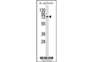 Image no. 2 for anti-Matrix Metallopeptidase 9 (Gelatinase B, 92kDa Gelatinase, 92kDa Type IV Collagenase) (MMP9) (AA 644-673), (C-Term) antibody (ABIN390154)