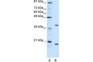 WB Suggested Anti-ZNF322A Antibody Titration:  0.