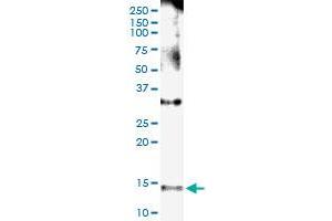 Image no. 3 for anti-Nephronophthisis 1 (Juvenile) (NPHP1) (AA 1-121) antibody (ABIN518422)