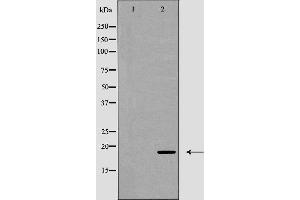 Image no. 1 for anti-CD247 Molecule (CD247) (pTyr142) antibody (ABIN6255812)