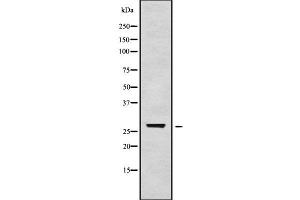 Image no. 1 for anti-TGFB-Induced Factor Homeobox 2-Like, X-Linked (TGIF2LX) antibody (ABIN6265553)