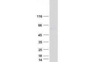 Image no. 1 for Bactericidal/Permeability Increasing Protein (BPI) protein (Myc-DYKDDDDK Tag) (ABIN2715321)