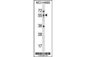 Image no. 1 for anti-Mex-3 Homolog B (MEX3B) (AA 37-65), (N-Term) antibody (ABIN1539323)