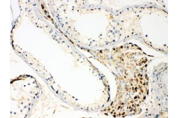 TECTA antibody  (AA 93-134)