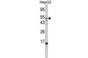 Image no. 1 for anti-Fucosidase, alpha-L- 1, Tissue (FUCA1) antibody (ABIN3002802)