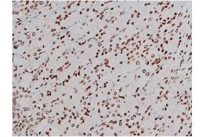Image no. 12 for anti-Mast/stem Cell Growth Factor Receptor (KIT) (pTyr721) antibody (ABIN6256004)