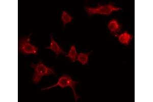 Image no. 2 for anti-AarF Domain Containing Kinase 2 (ADCK2) (Internal Region) antibody (ABIN6256924)