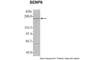 Image no. 2 for anti-SUMO1/sentrin Specific Protease 6 (SENP6) (C-Term) antibody (ABIN2784245)