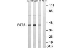 Image no. 1 for anti-Mitochondrial Ribosomal Protein S35 (MRPS35) (AA 211-260) antibody (ABIN1534510)
