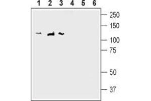 Western blot analysis of rat brain membranes (lanes 1 and 4), mouse brain membranes (lanes 2 and 5) and human SH-SY5Y neuroblastoma cell line lysate (lanes 3 and 6): - 1-3.