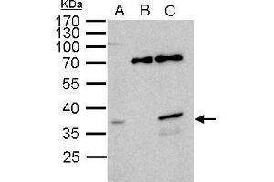 Image no. 2 for anti-Williams Beuren Syndrome Chromosome Region 22 (WBSCR22) (Center) antibody (ABIN2856201)
