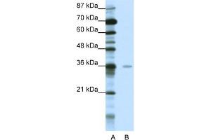 Image no. 1 for anti-Methyl-CpG Binding Domain Protein 2 (MBD2) (Middle Region) antibody (ABIN2778640)