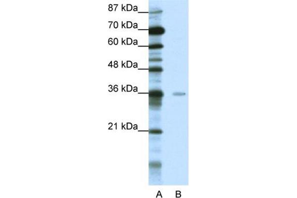 anti-Methyl-CpG Binding Domain Protein 2 (MBD2) (Middle Region) antibody
