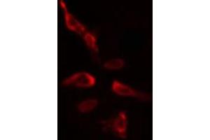 Image no. 1 for anti-SLU7 Splicing Factor Homolog (SLU7) (Internal Region) antibody (ABIN6259555)