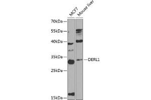 DERL1 Antikörper  (AA 182-251)