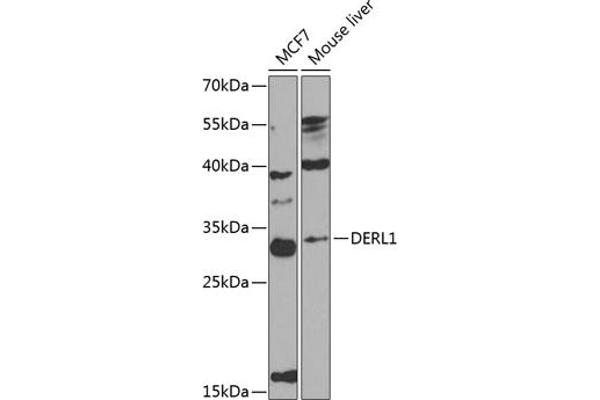 DERL1 Antikörper  (AA 182-251)