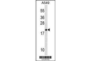 Image no. 1 for anti-Mitochondrial Ribosomal Protein L40 (MRPL40) (AA 172-200), (C-Term) antibody (ABIN1536780)