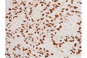 Image no. 5 for anti-REL proto-oncogene (c-Rel) (pSer503) antibody (ABIN6255382)