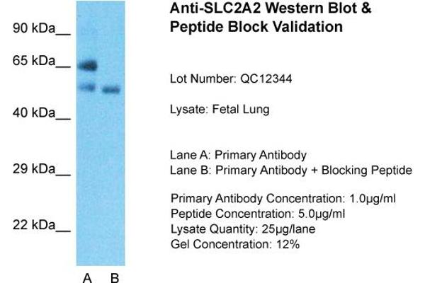 anti-Solute Carrier Family 2 (Facilitated Glucose Transporter), Member 2 (SLC2A2) (N-Term) antibody