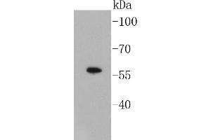 Image no. 1 for anti-SMAD, Mothers Against DPP Homolog 3 (SMAD3) antibody (ABIN5557524)