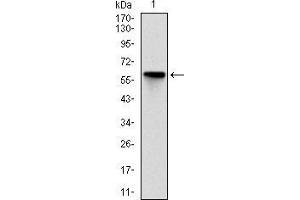 Image no. 2 for anti-rho-Associated, Coiled-Coil Containing Protein Kinase 1 (ROCK1) antibody (ABIN969563)