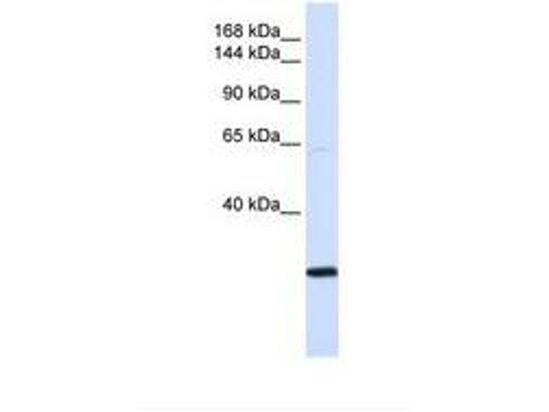 anti-SMC2 antibody (AA 51-100) | Product No. ABIN6738200