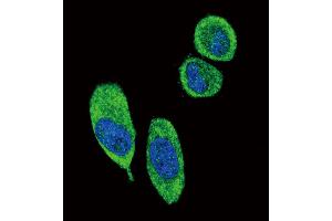 Image no. 3 for anti-Stratifin (SFN) (AA 222-248), (C-Term) antibody (ABIN5535412)