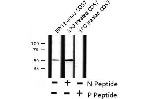 Image no. 1 for anti-Retinoid X Receptor, alpha (RXRA) (pSer260) antibody (ABIN6271594)