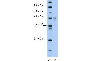 Image no. 1 for anti-Pyruvate Dehydrogenase Kinase, Isozyme 4 (PDK4) (N-Term) antibody (ABIN2777592)