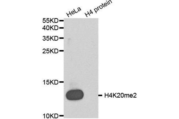 Histone H4 anticorps  (2meLys20)