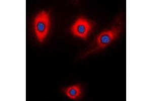 Image no. 1 for anti-Kalirin, RhoGEF Kinase (KALRN) (Center) antibody (ABIN2706430)