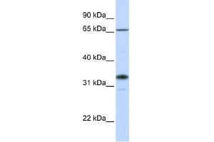 Image no. 1 for anti-UDP-Gal:betaGlcNAc beta 1,3-Galactosyltransferase, Polypeptide 1 (B3GALT1) (C-Term) antibody (ABIN635750)