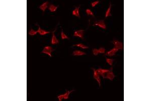 Image no. 1 for anti-Complement Component 1, Q Subcomponent-Like 2 (C1QL2) (C-Term) antibody (ABIN6258547)