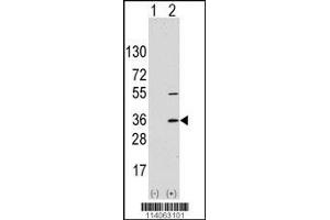 Image no. 3 for anti-Signal Sequence Receptor, alpha (SSR1) (AA 17-46), (N-Term) antibody (ABIN5532147)